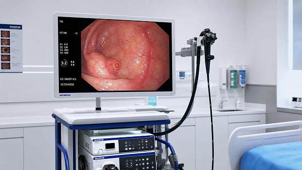 Endoscopic Imaging Technology in GI Diagnosis: Key Features and Common Image Quality Issues