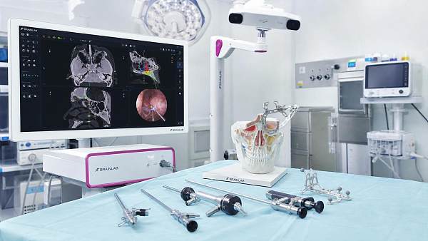 Intraoperative Navigation for ENT Surgery: Accuracy, Workflow, and Limits