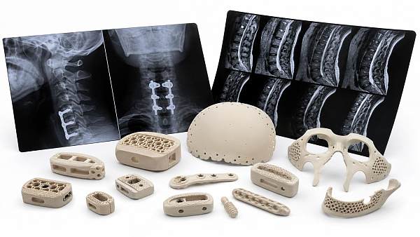 PEEK Medical Implants Win on Imaging but Not Every Time