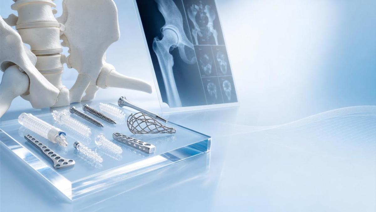 Do Biodegradable Implants Cut Revision Costs? Do Biodegradable Implants Cut Revision Costs?