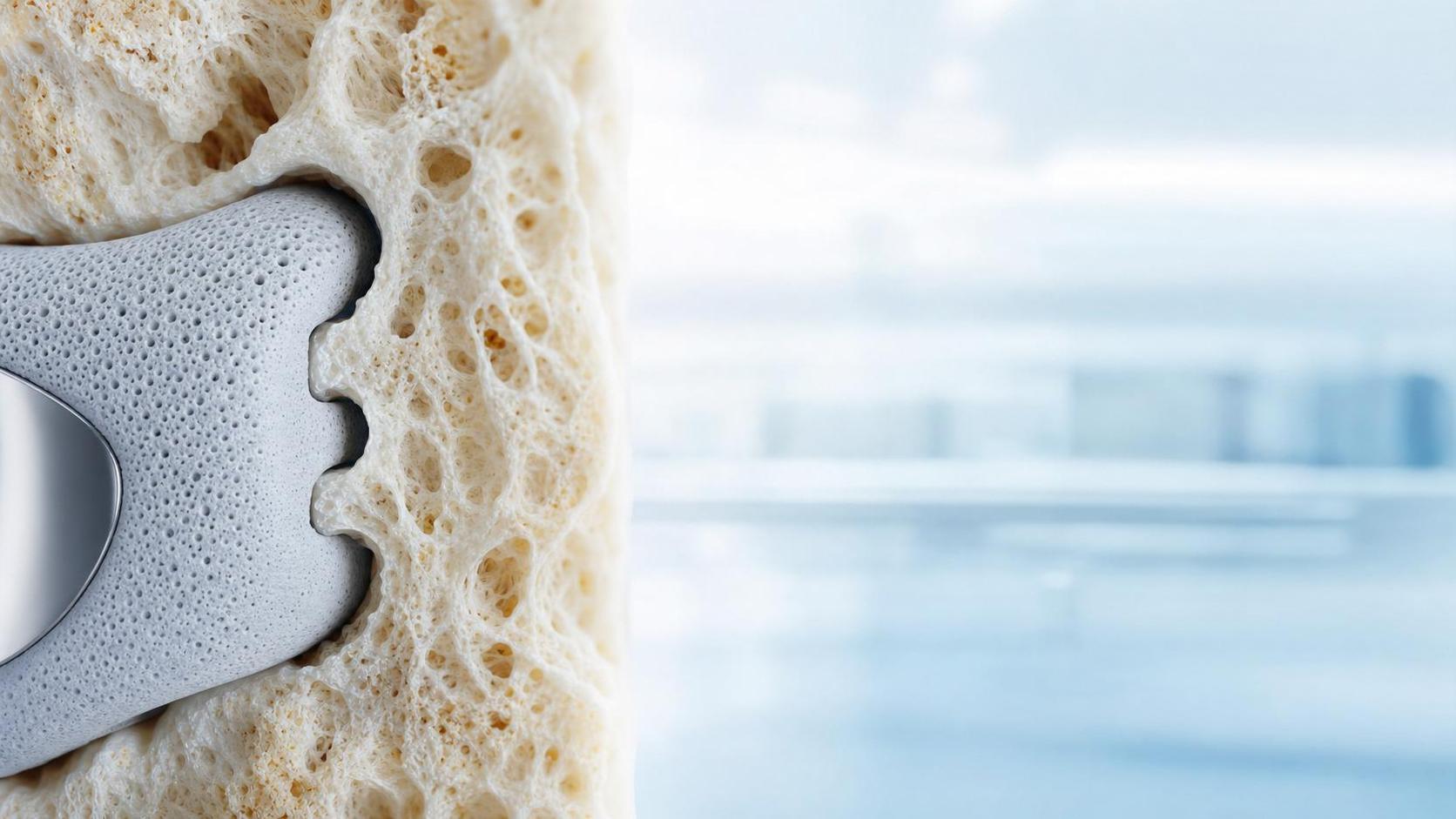 How Implantable Biomaterials Ceramics Affect Strength and Osseointegration