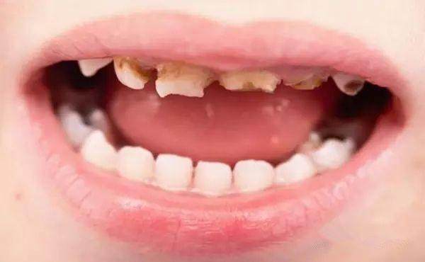 Advancing Caries Detection: Innovative Solutions from Baibo