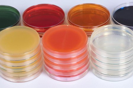 Ensuring Food Safety with Plate Count Agar | Babio Biotechnology