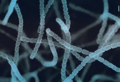 Why Potato Dextrose Agar (USP) Is a Must-Have for Modern Mold & Yeast Detection？