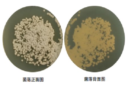 BABIO Enhances Global Microbiology with Potato Dextrose Agar Medium