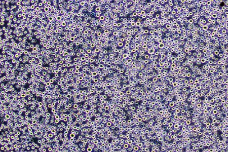 BABIO Expands Specimen Transport Solutions for Microbiology Laboratories