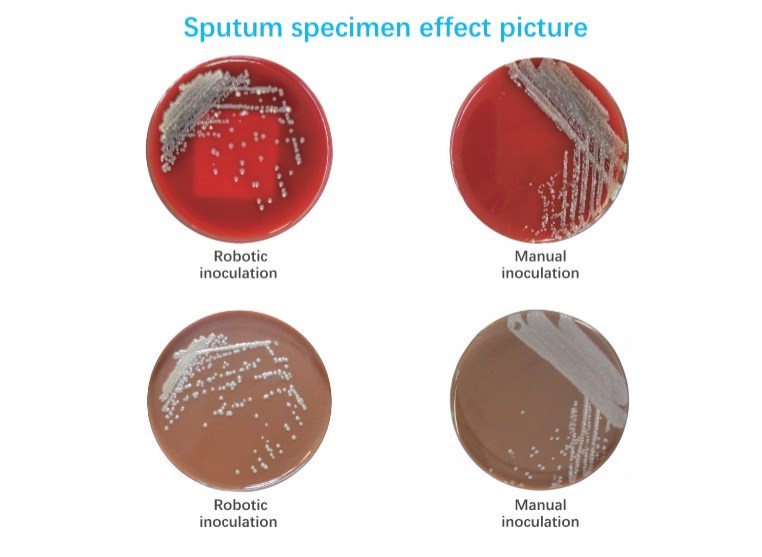 痰液标本效果图.jpg Sophbabio Microbial sample pretreatment system