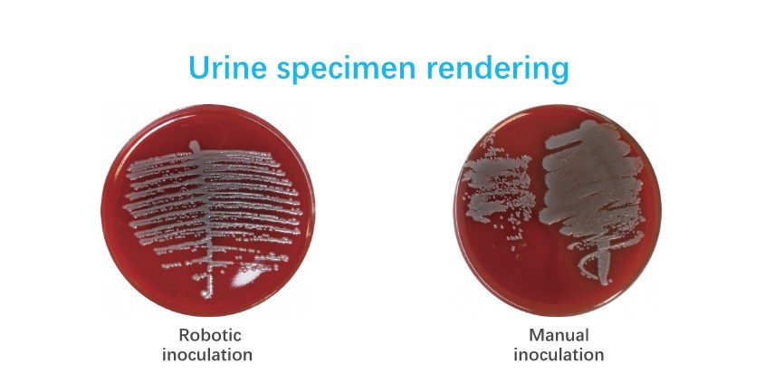 尿液标本效果图.jpg Sophbabio Microbial sample pretreatment system