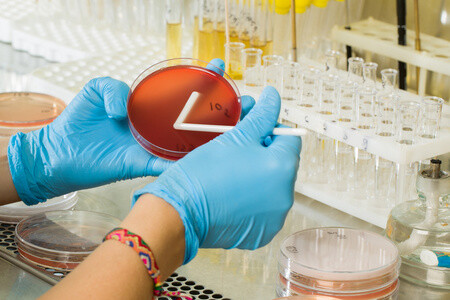 Améliorer la sécurité alimentaire avec la gélose Violet Red Bile Dextrose Agar de BABIO