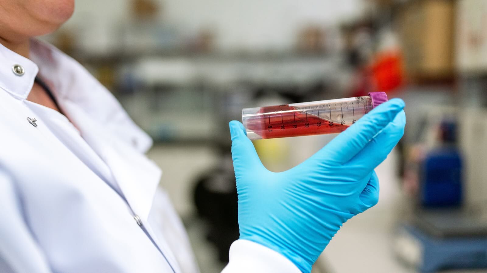 BABIO lance une solution saline tamponnée au phosphate (PBS) de haute qualité pour le diagnostic clinique mondial