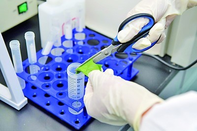 Casete de prueba rápida de aflatoxina B1: Cumplimiento de los estándares mundiales de seguridad alimentaria en medio de la creciente preocupación en las cadenas de suministro de alimentos y piensos.