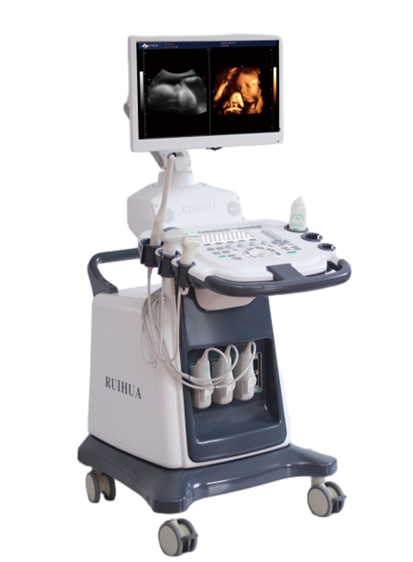 Color Doppler Ultrasound DU8-M8