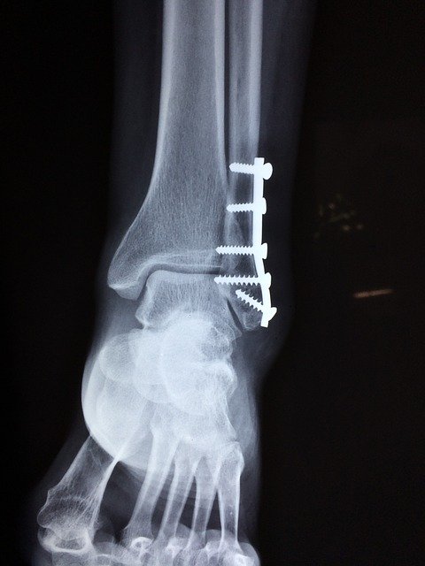 Medical