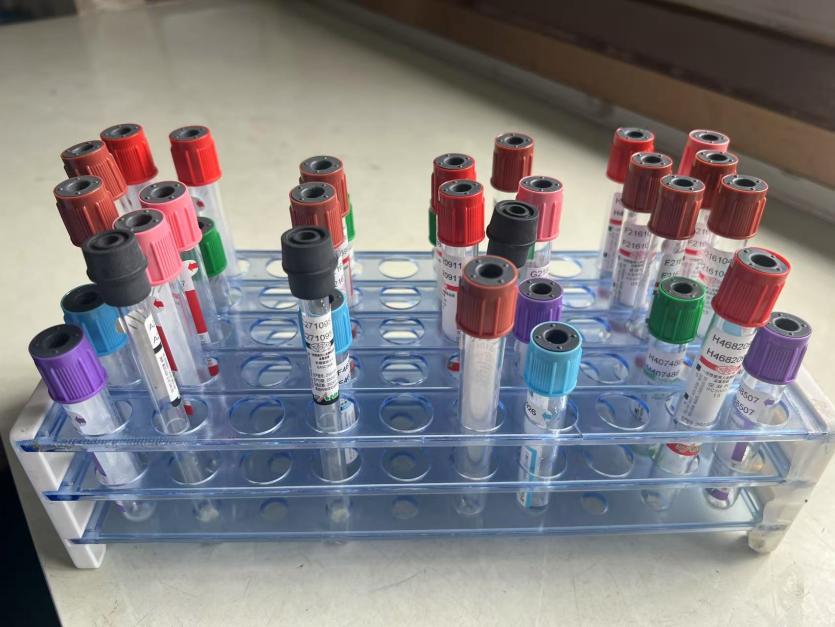 High-transparency acrylic blood vessel holder: durable and user-friendly