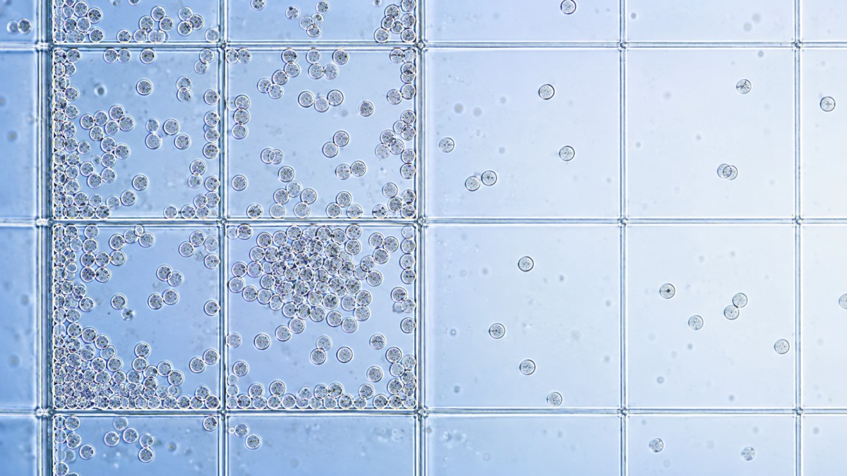 How uneven cell distribution affects precise hemacytometer counts How uneven cell distribution affects precise hemacytometer counts