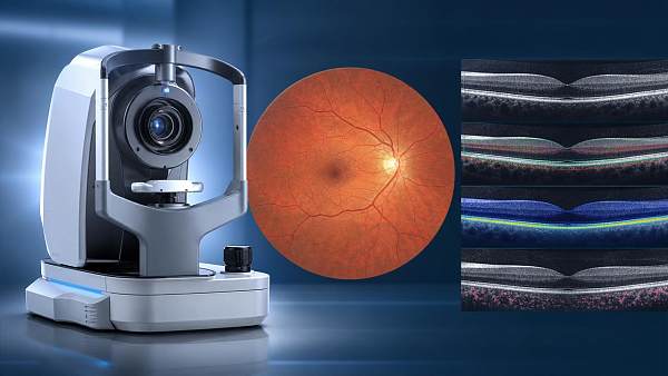 What Affects Image Quality in Modern Ophthalmic Equipment?