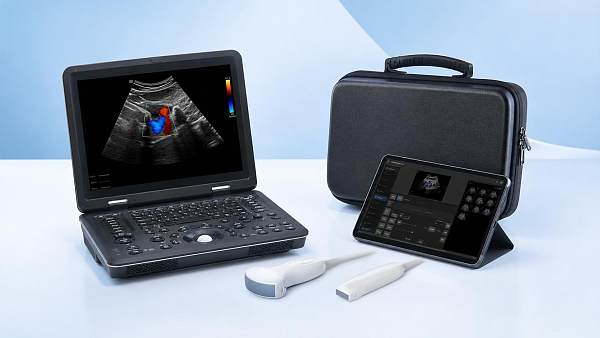 Portable Ultrasound Scanners: Key Specs to Compare for Clinic and Home Use