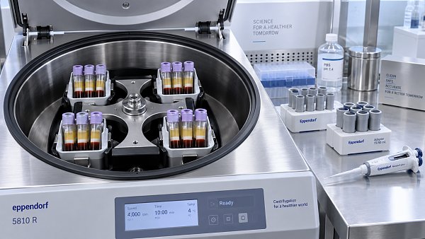 How to Select a Refrigerated Centrifuge for Reliable Plasma Separation